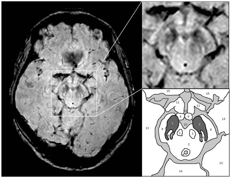 This image shows the anatomy of the substantia nigra.