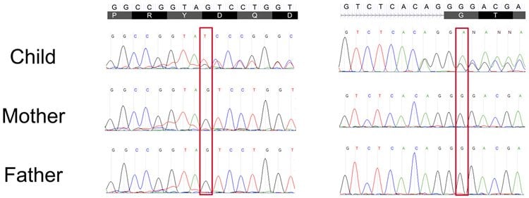  This image shows the genetic sequencing in a graph of parents and child.