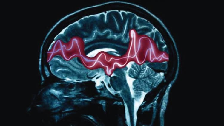 This image shows a brain scan with a pink line representing electrical activity.