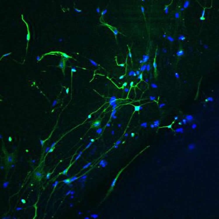 This image mature neurons generated from human stem cells.