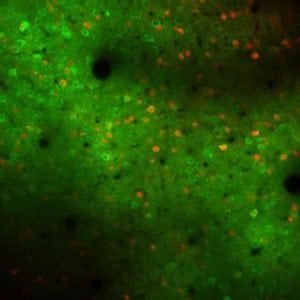 This image shows a mouse motor cortex brain slice with active neurons highlighed in green.
