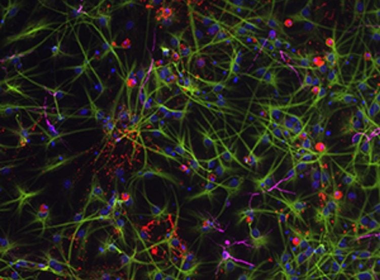 This image shows neural stem cells.
