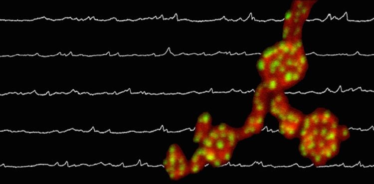 This image shows the drosophila synapse superimposed over an electrophysiology recording.
