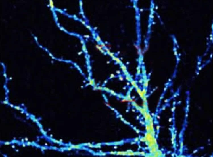 This image shows a mouse hippocampal neuron.