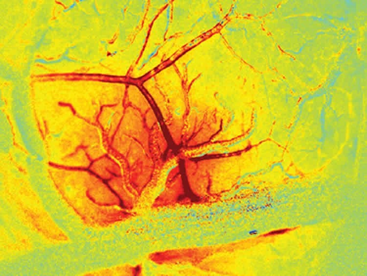 This image shows the increased bloodflow in the brain.