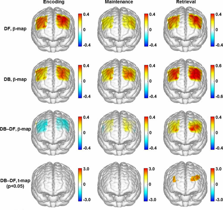 The image shows topographic images of the task evoked prefrontal activations.