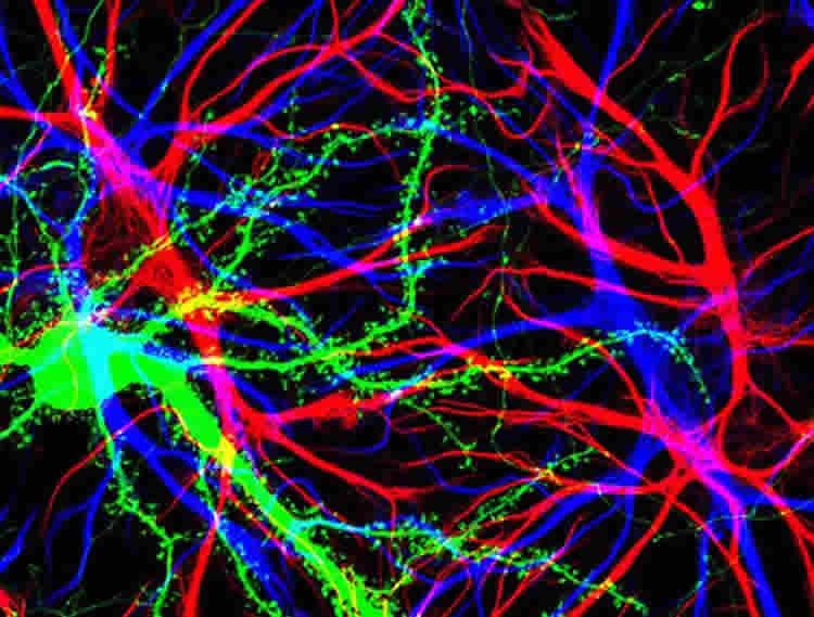 The image shows hippocampal neurons and dendrites.