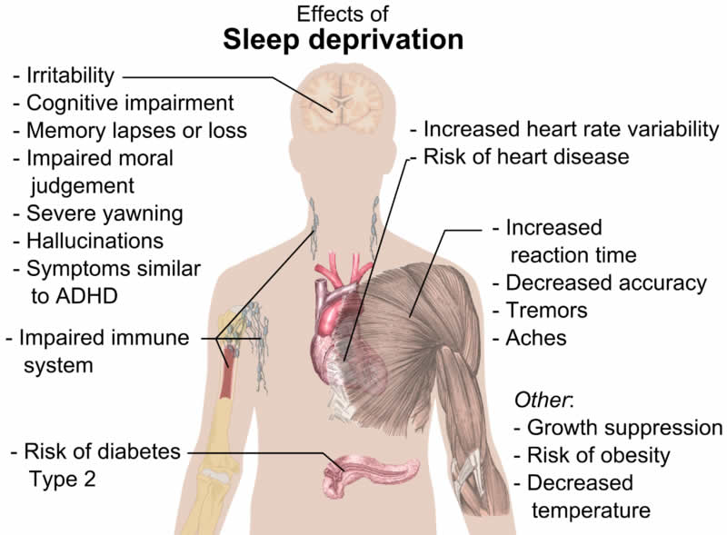 The image shows a diagram which details the effects of sleep deprivation on the body.