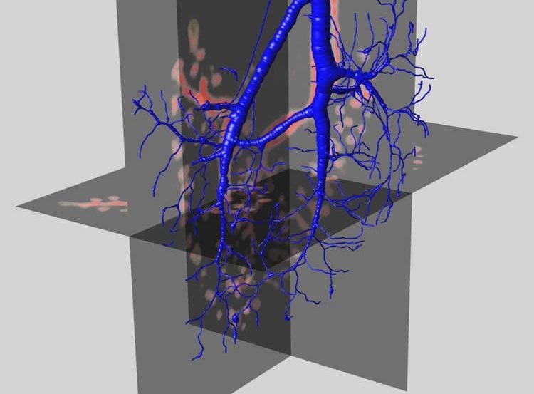 The image shows a representation of a neuron created by the virtual finger.