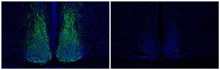 The image shows Vip reduction in mouse brains.