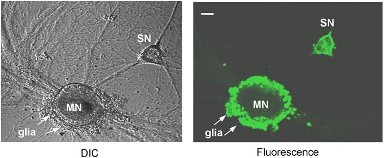 The image shows ApHTT mRNA expression in Aplysia sensory neurons.