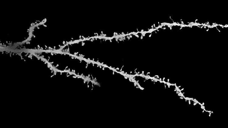 This image is a neuron from the brain of a young person with autism.