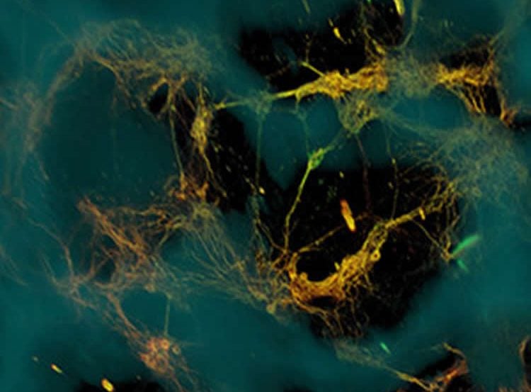 The image shows a confocal microscope image of neurons.