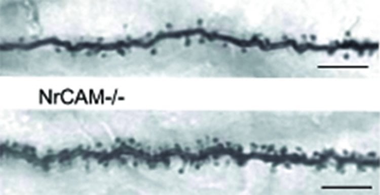 The image is comparison of a dendrite with the protein NrCAM (top) and a dendrite without the protein (bottom).