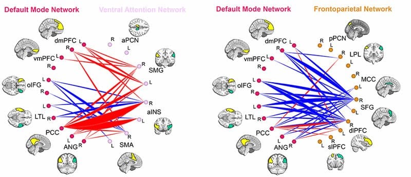 The image shows 2 diagrams which show the lagged maturation of the neural connections in ADHD.