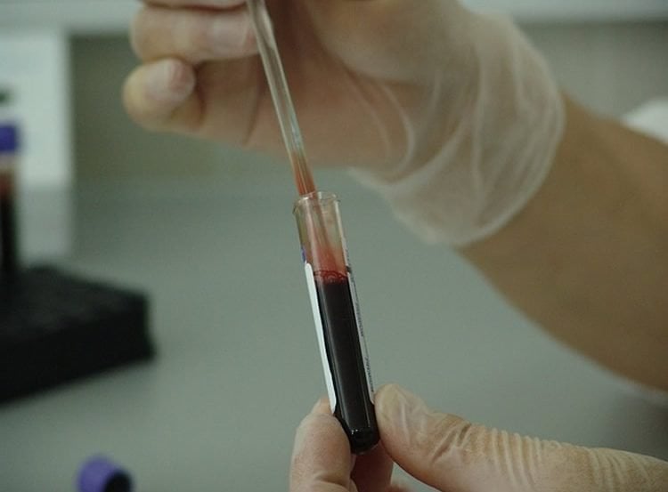 The image shows a person testing a blood sample from a test tube.