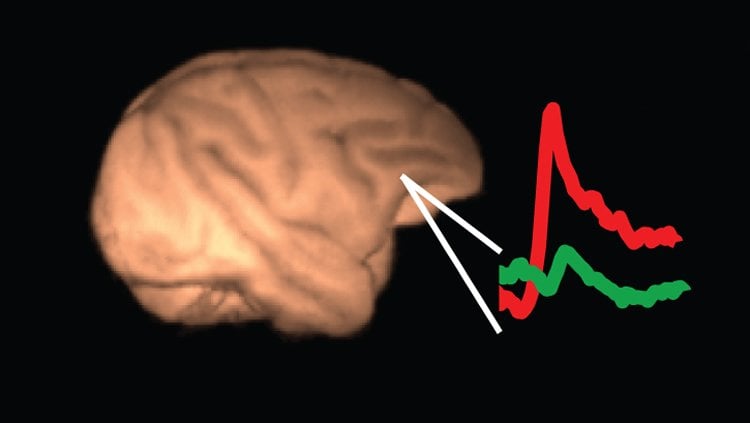 This image shows a brain with lines depicting neural activity.