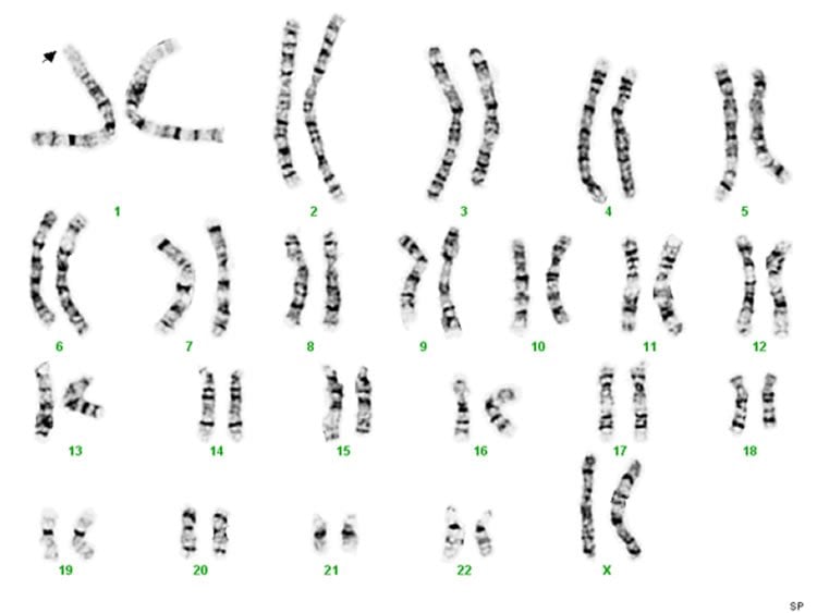 The image shows different chromosomes in a chart.
