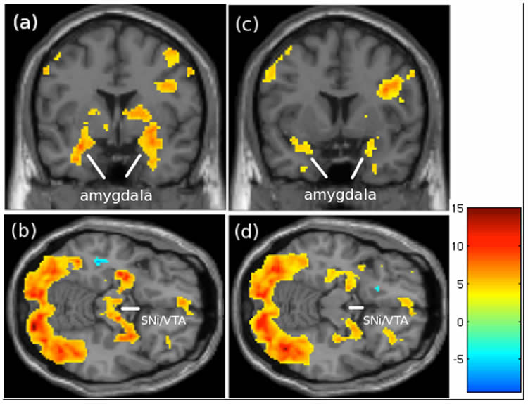 The image shows fmri scans from the research.