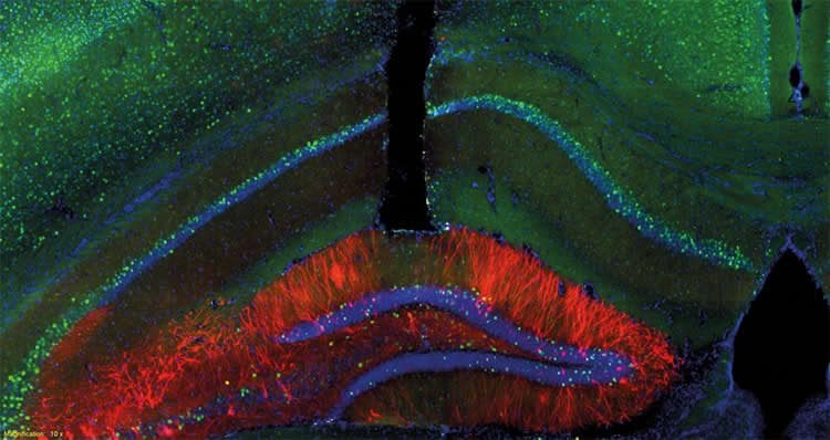 This image shows a mouse hippocampus.