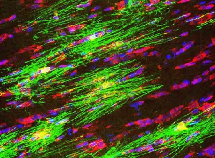 This image shows oligodendrocytes and myelin in adult mice.