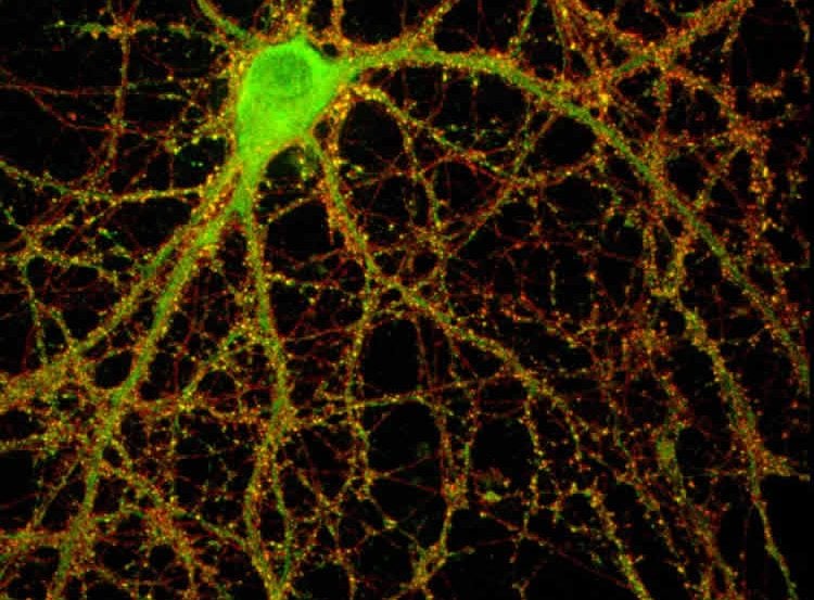 This image shows mouse hippocampal neurons and synapses.