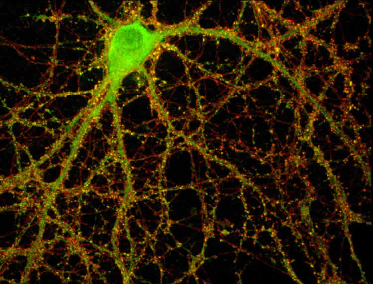 This image shows mouse hippocampal neurons and synapses.