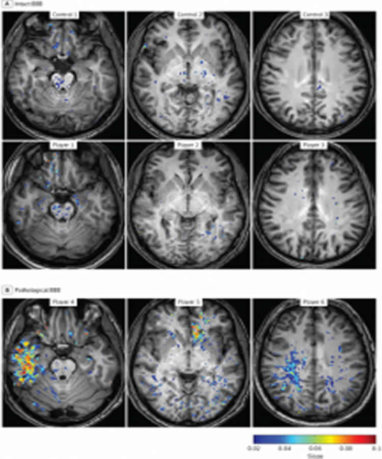 This image shows MRI brain scans taken from the study.