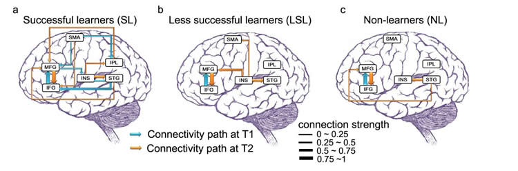 This image shows schematics of connectivity in the brain.