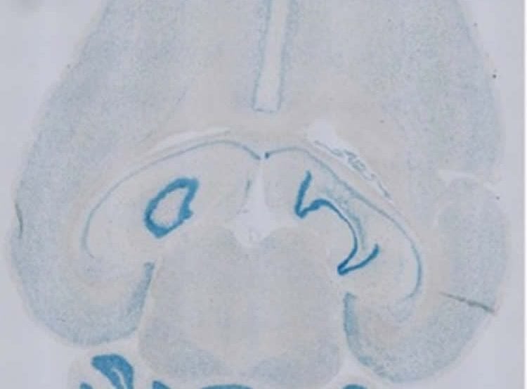 This image shows a brain slice.