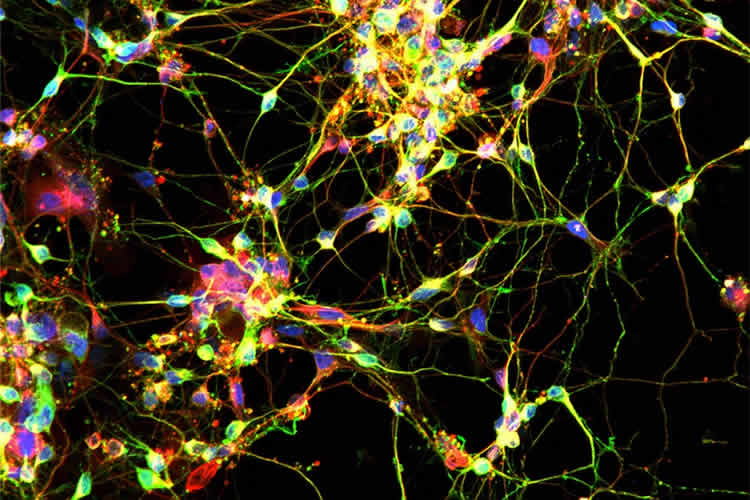 This image shows the neurons created as part of this experiment.