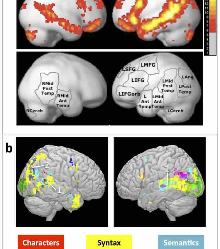 The image shows fMRI scans taken during the research.