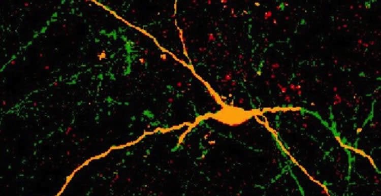 This image shows one of the interneurons derived from hpscs.