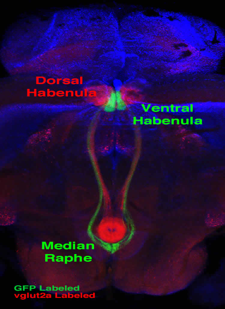 This image shows the median raphe and ventral habenula.