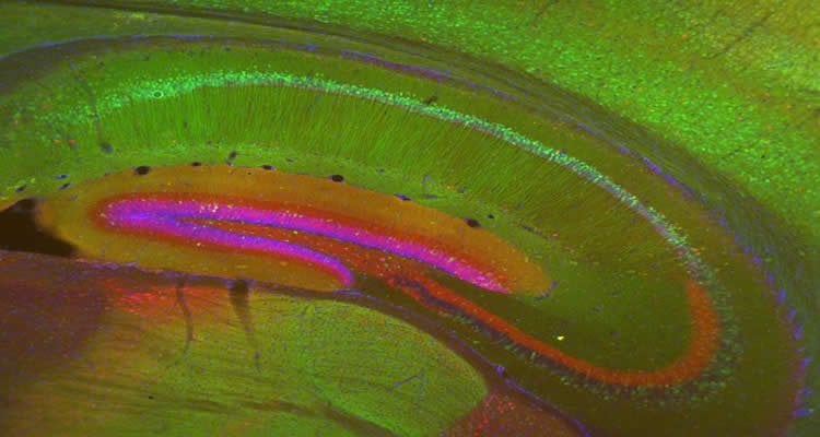 The image shows the hippocampus of a transgenic mouse. The image is stained in green, red and blue.