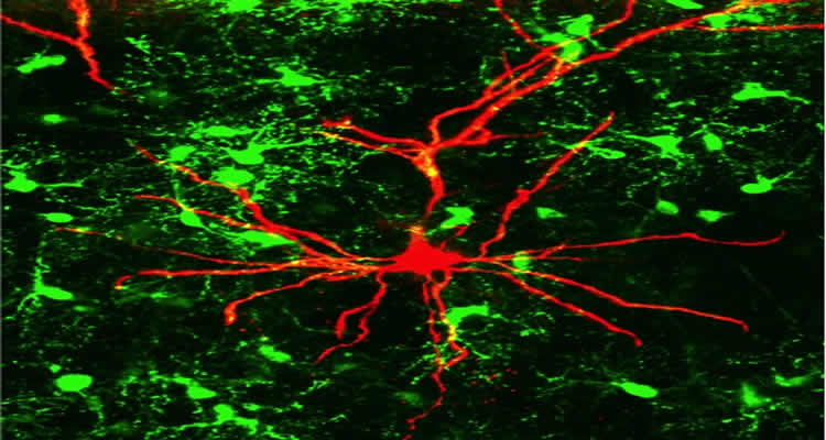 The image shows stained oligodendrocyte progenitor cells in the brain.