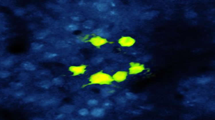 The image shows the neurons in the mouse cortex which were activated by light.