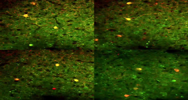 The image shows neurons from the primary visual cortex of an awake mouse.