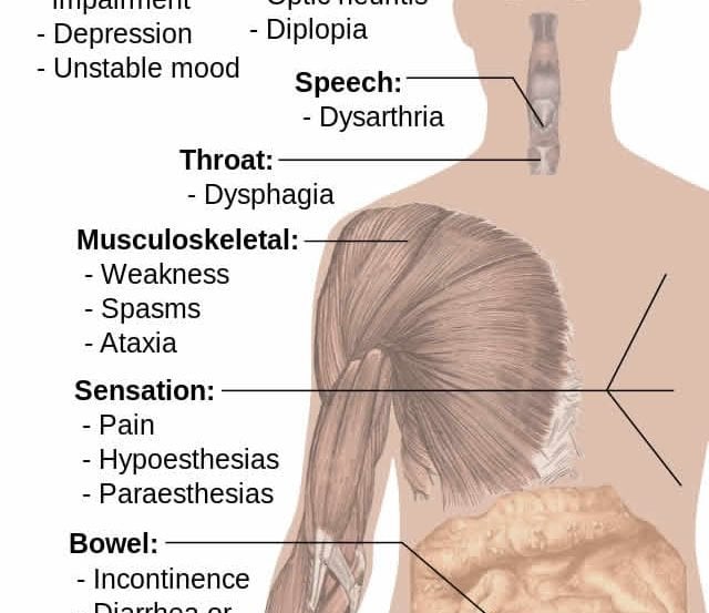 The image is a diagram showing the effects MS has on the human body.