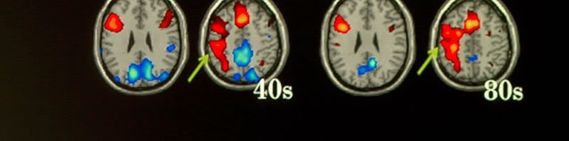 The image shows fMRI scans taken from the research.