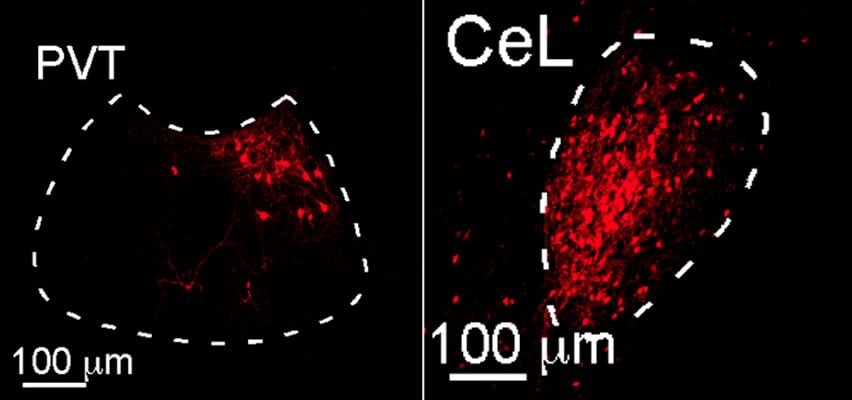 This image shows the neurons in red.