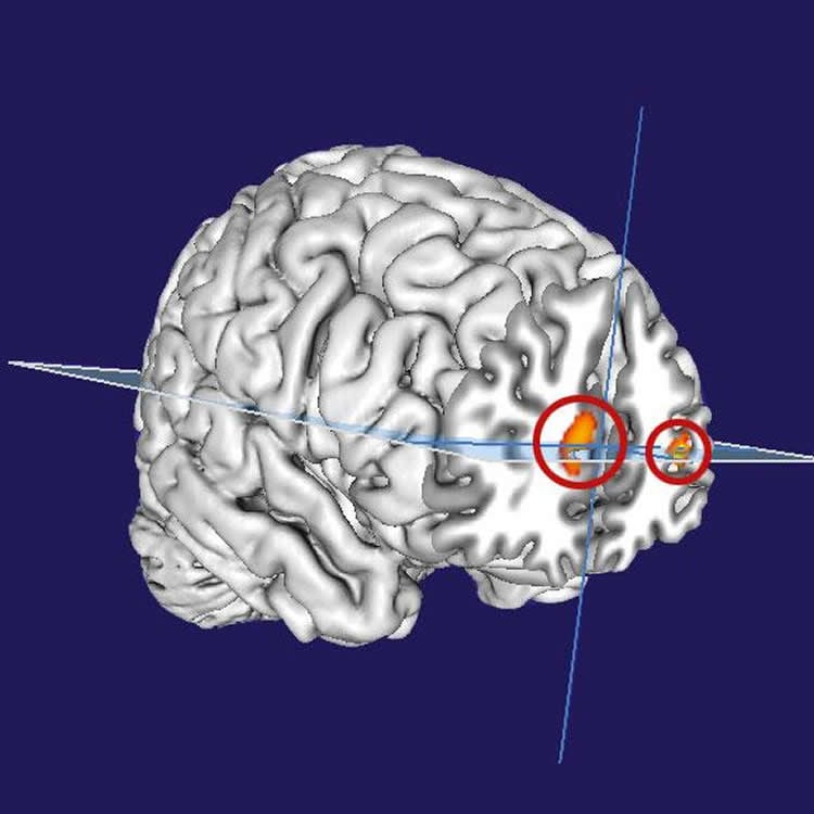 This image shows a computer generated representation of the brain with the prefrontal cortex highlighted in red and orange.
