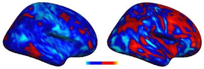 This image shows two brain scans which compare the extent of the voxel deviation in people with autism.