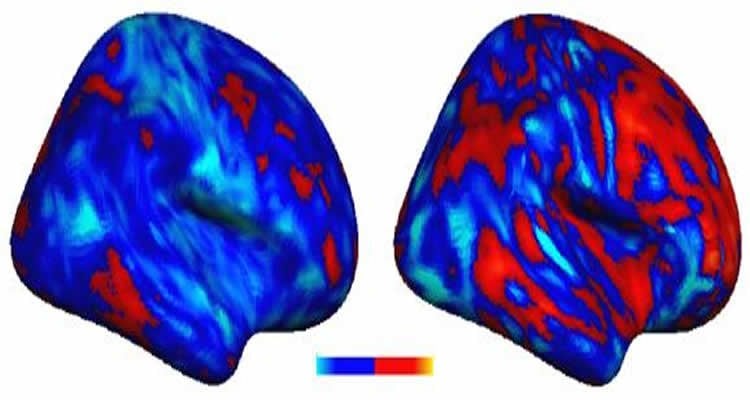 This image shows two brain scans which compare the extent of the voxel deviation in people with autism.