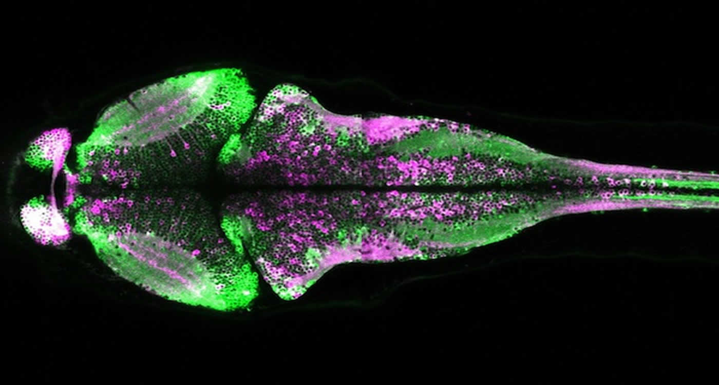 This image shows the CaMPARI flurescence in a larval zebrafish brain.