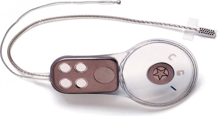 The image shows an auditory brainstem implant.