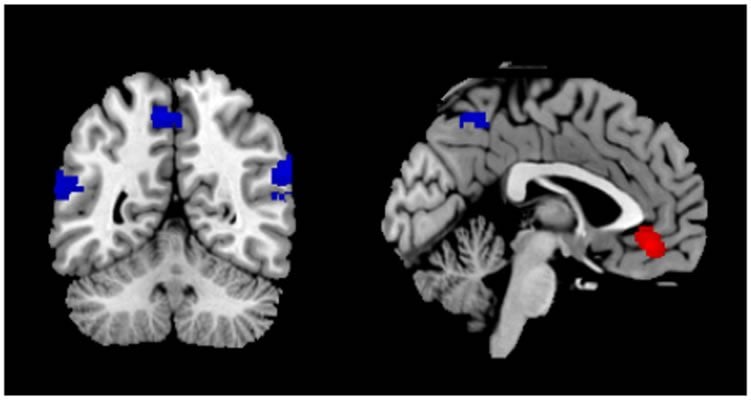 This image shows fMRI brain scans taken from the study.