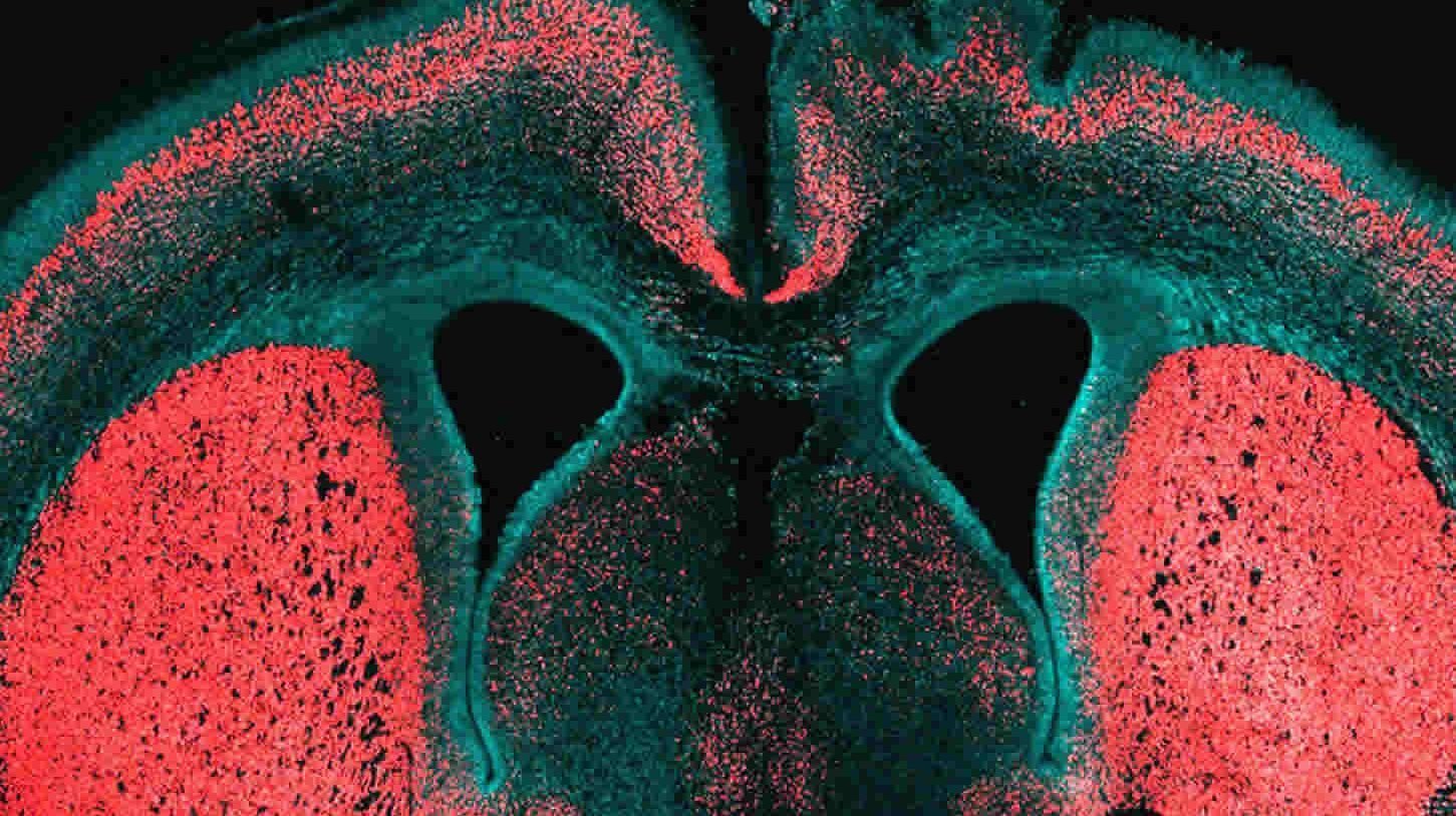 This image shows a brain slice of an embryonic mouse cerebral cortex. The caption best describes the image.