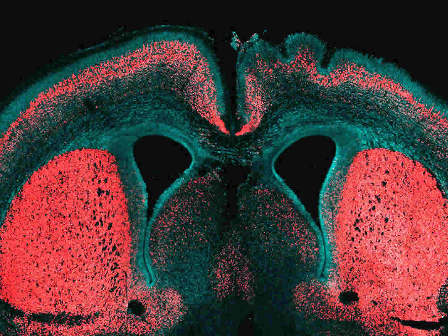 This image shows a brain slice of an embryonic mouse cerebral cortex. The caption best describes the image.