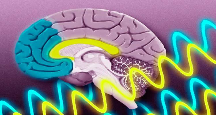 This image shows a brain surrounded by waving yellow and blue bands.